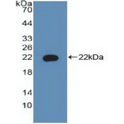 Bcl2 Associated Death Promoter (BAD) Antibody