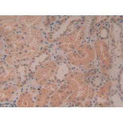 Bcl2 Associated Death Promoter (BAD) Antibody