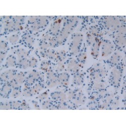 Fibroblast Growth Factor 18 (FGF18) Antibody