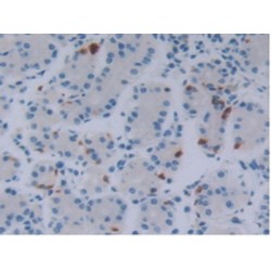 Fibroblast Growth Factor 18 (FGF18) Antibody