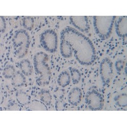 Cytochrome P450 24A1 (CYP24A1) Antibody