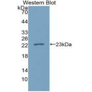 Western blot analysis of the recombinant protein.