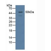 Western blot analysis of Human Jurkat Cells.