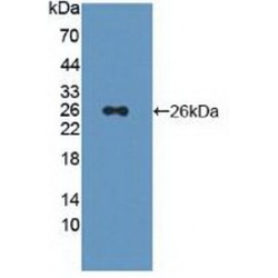 26S Proteasome Non-ATPase Regulatory Subunit 5 (PSMD5) Antibody