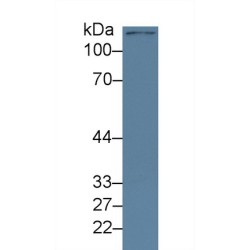 Lysine Specific Demethylase 4A (KDM4A) Antibody