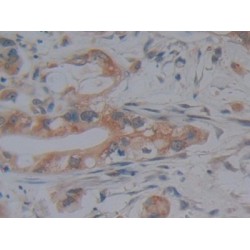 Lysine Specific Demethylase 4A (KDM4A) Antibody