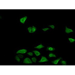 Fructosamine-3-Kinase (FN3K) Antibody