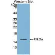 Western blot analysis of the recombinant protein.