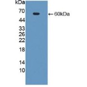 Western blot analysis of recombinant Human ADA2.