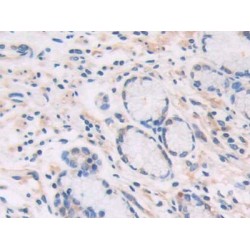 Adenosine Deaminase 2 (ADA2) Antibody