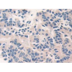 Adenosine Deaminase 2 (ADA2) Antibody