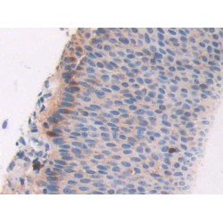 Adenosine Deaminase 2 (ADA2) Antibody