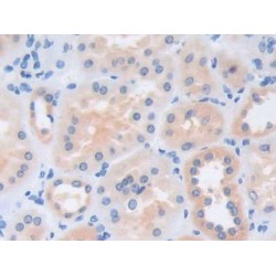 Adenosine Deaminase 2 (ADA2) Antibody