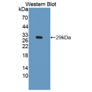 Western blot analysis of the recombinant protein.