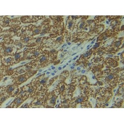 DIX Domain Containing Protein 1 (DIXDC1) Antibody