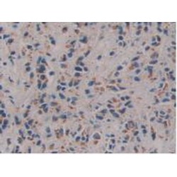 Protein FAM3C (FAM3C) Antibody