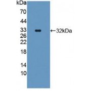 Western blot analysis of recombinant Human SCAF11.