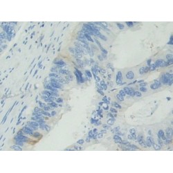 Basal Cell Adhesion Molecule (BCAM) Antibody