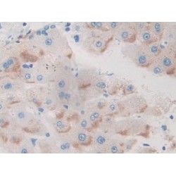 Basal Cell Adhesion Molecule (BCAM) Antibody