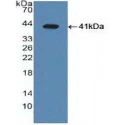 Liver X Receptor Alpha (LXRa) Antibody