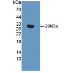 Integrin Beta 6 (ITGb6) Antibody