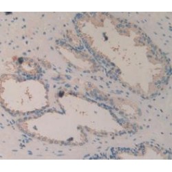 Integrin Beta 6 (ITGb6) Antibody