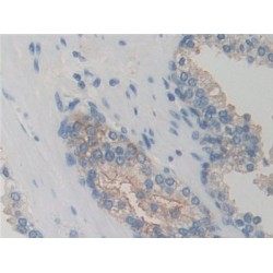 G Protein Coupled Receptor Kinase 6 (GRK6) Antibody