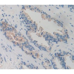 G Protein Coupled Receptor Kinase 6 (GRK6) Antibody