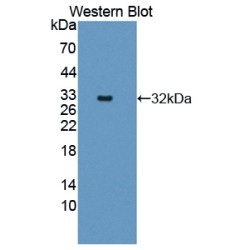 Catenin Alpha 1 (CTNNa1) Antibody