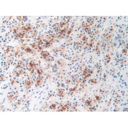 Glutamate Carboxypeptidase II (GCPII) Antibody