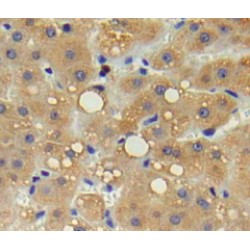 Interleukin 17 Receptor B (IL17RB) Antibody