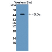 Western blot analysis of the recombinant protein.