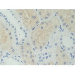 Adenosylhomocysteinase (AHCY) Antibody