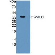 Western blot analysis of recombinant Human NEIL1.