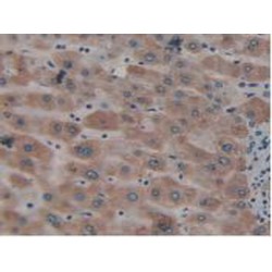 Nei Endonuclease VIII Like Protein 1 (NEIL1) Antibody