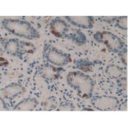 Nei Endonuclease VIII Like Protein 1 (NEIL1) Antibody