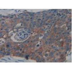 Nei Endonuclease VIII Like Protein 1 (NEIL1) Antibody