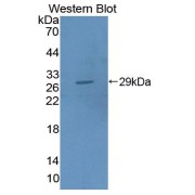 Western blot analysis of the recombinant protein.