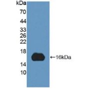 Western blot analysis of recombinant Human MYCBP.