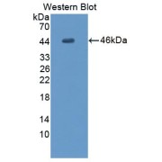 Western blot analysis of the recombinant Human MYPN protein.