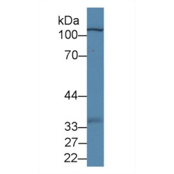 Myopalladin (MYPN) Antibody