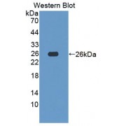 Western blot analysis of the recombinant protein.