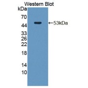 Western blot analysis of the recombinant protein.