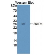 Western blot analysis of recombinant Human CDH23.