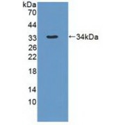 Western blot analysis of recombinant Human DYNC1H1.