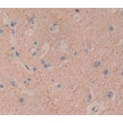 Dynein, Cytoplasmic 1, Heavy Chain 1 (DYNC1H1) Antibody