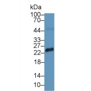 Western blot analysis of Pig Eye lysate, using Rabbit Anti-Human Retinoschisin Antibody (1 µg/ml) and HRP-conjugated Goat Anti-Rabbit antibody (<a href="https://www.abbexa.com/index.php?route=product/search&amp;search=abx400043" target="_blank">abx400043</a>, 0.2 µg/ml).