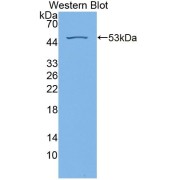 Western blot analysis of recombinant Human Retinoschisin Protein.