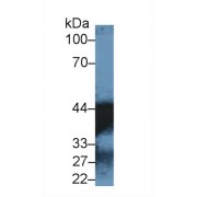 Western blot analysis of Human Lung lysate, using Human MDH1 Antibody (1 µg/ml) and HRP-conjugated Goat Anti-Rabbit antibody (<a href="https://www.abbexa.com/index.php?route=product/search&amp;search=abx400043" target="_blank">abx400043</a>, 0.2 µg/ml).