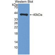 Western blot analysis of the recombinant protein.